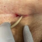 0326459 - SPC Erosion - Photo #3