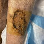 0956100 - Photo 1 - 20240122