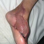 0995622 - Picture 1 - 202122011