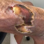 1037263 - Photo 1- 20240308