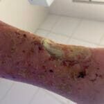 12272901- Photo 3 - 20240306