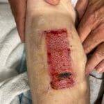 2222 - Photo 1 - 20240122