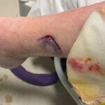 3566063 - Photo 1 - 20240116