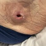 8122175- Photo 1 - 20240122