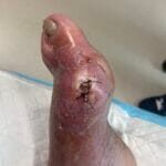 Gout - 0736712 - Photo 1