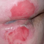 IAD - Category 2 (b)